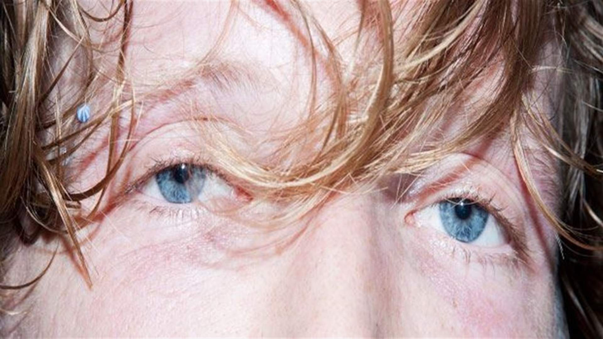 [Photos] This Is What Your Eyes Look Like On Drugs
