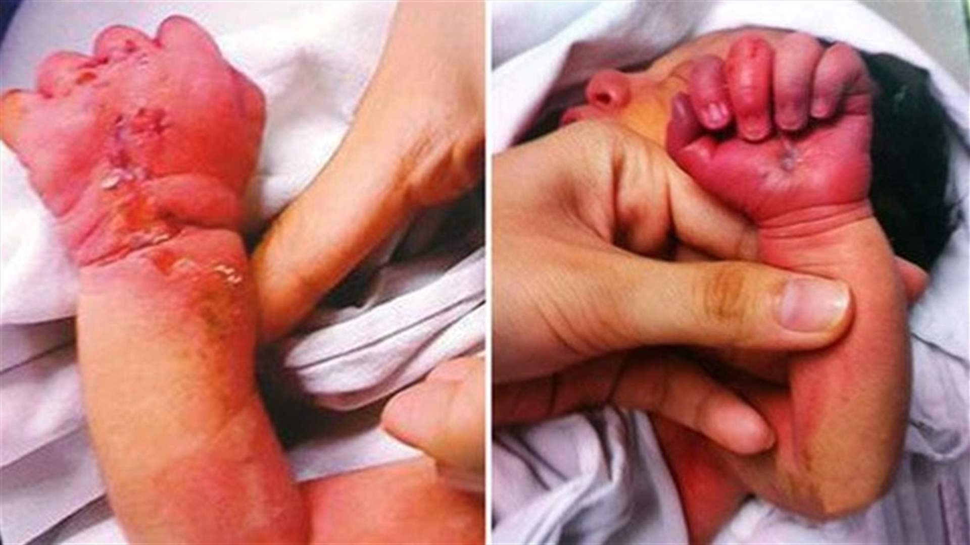 [PHOTOS] Cannibal Mother Tries To Eat Her Baby Days After Giving Birth!