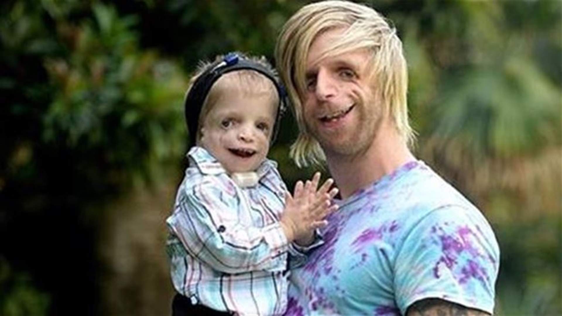 [PHOTOS] Inspirational Man Travels to Australia to Meet Kid With The Same Rare Genetic Condition