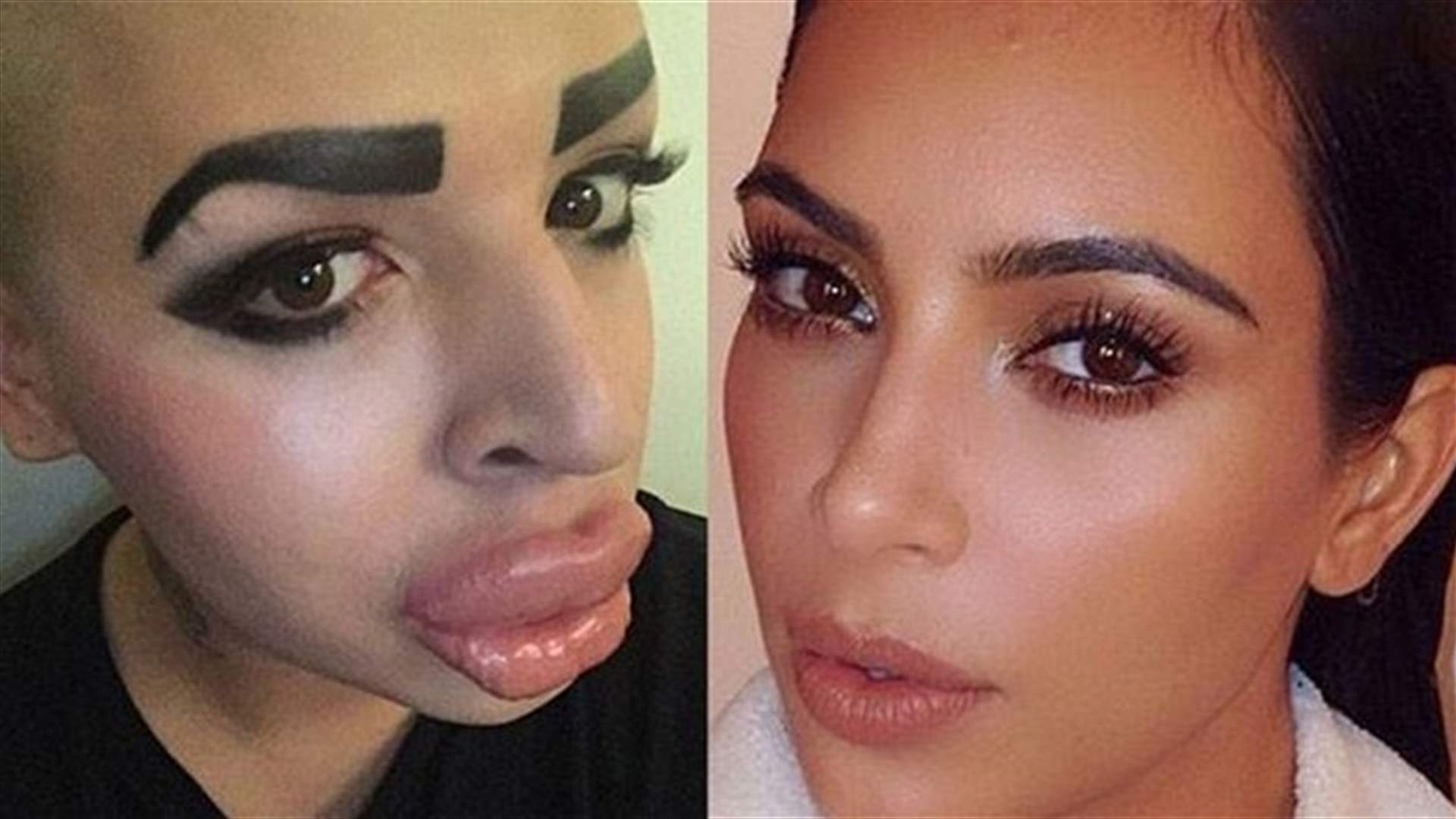 [VIDEO] Man Spends Fortune On Plastic Surgery To Look More Like Kim Kardashian!