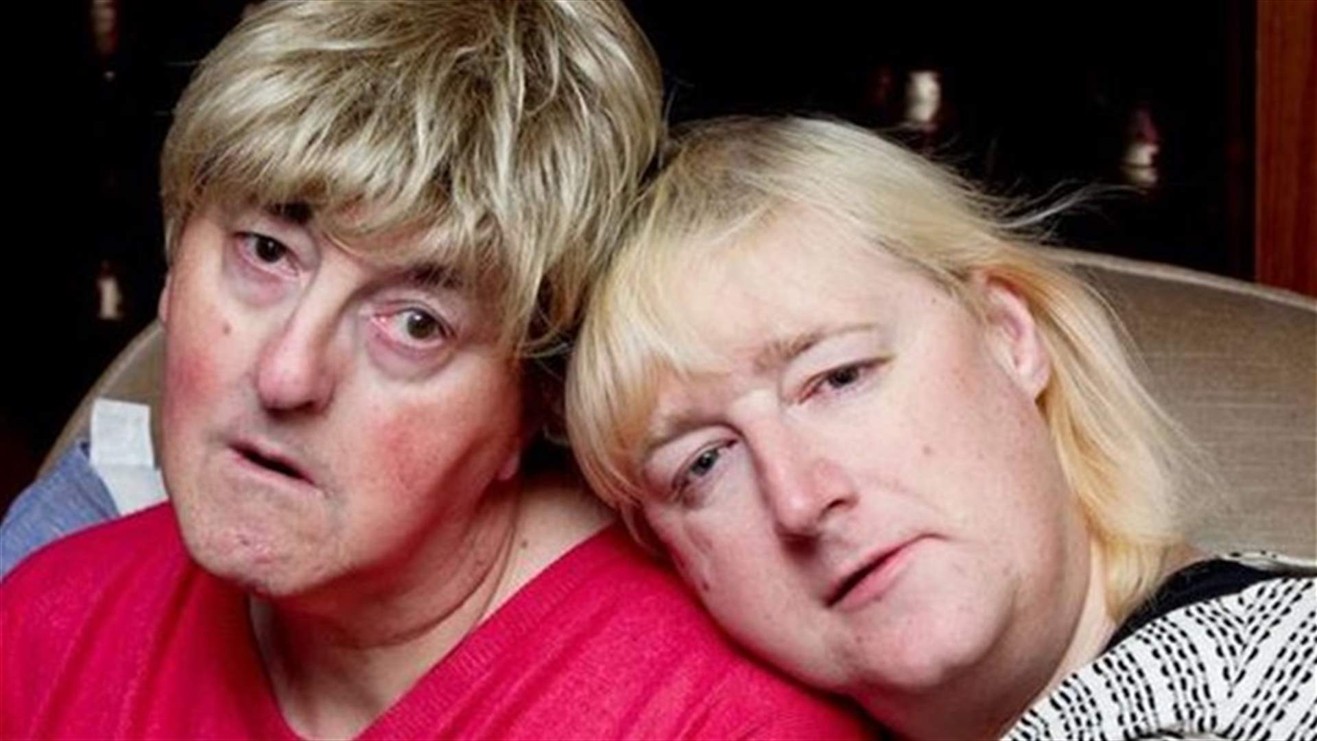 [PHOTOS] Two Men Fall In Love, Undergo Sex Change Operations, Prepare To Get Married As Lesbians