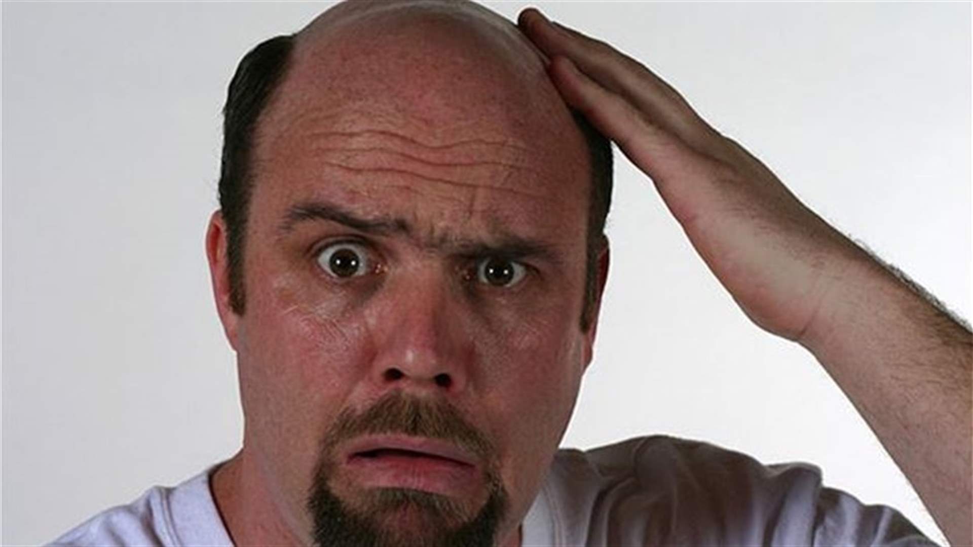 Scientists Closer More Than Ever To Finding Cure For Baldness