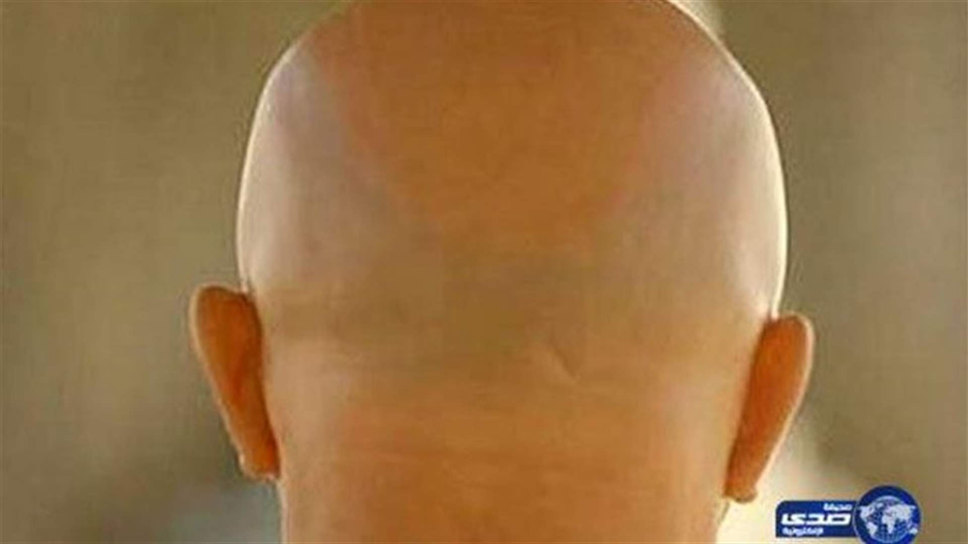 عروس مصرية طلبت الطلاق بعد اكتشاف صلع زوجها