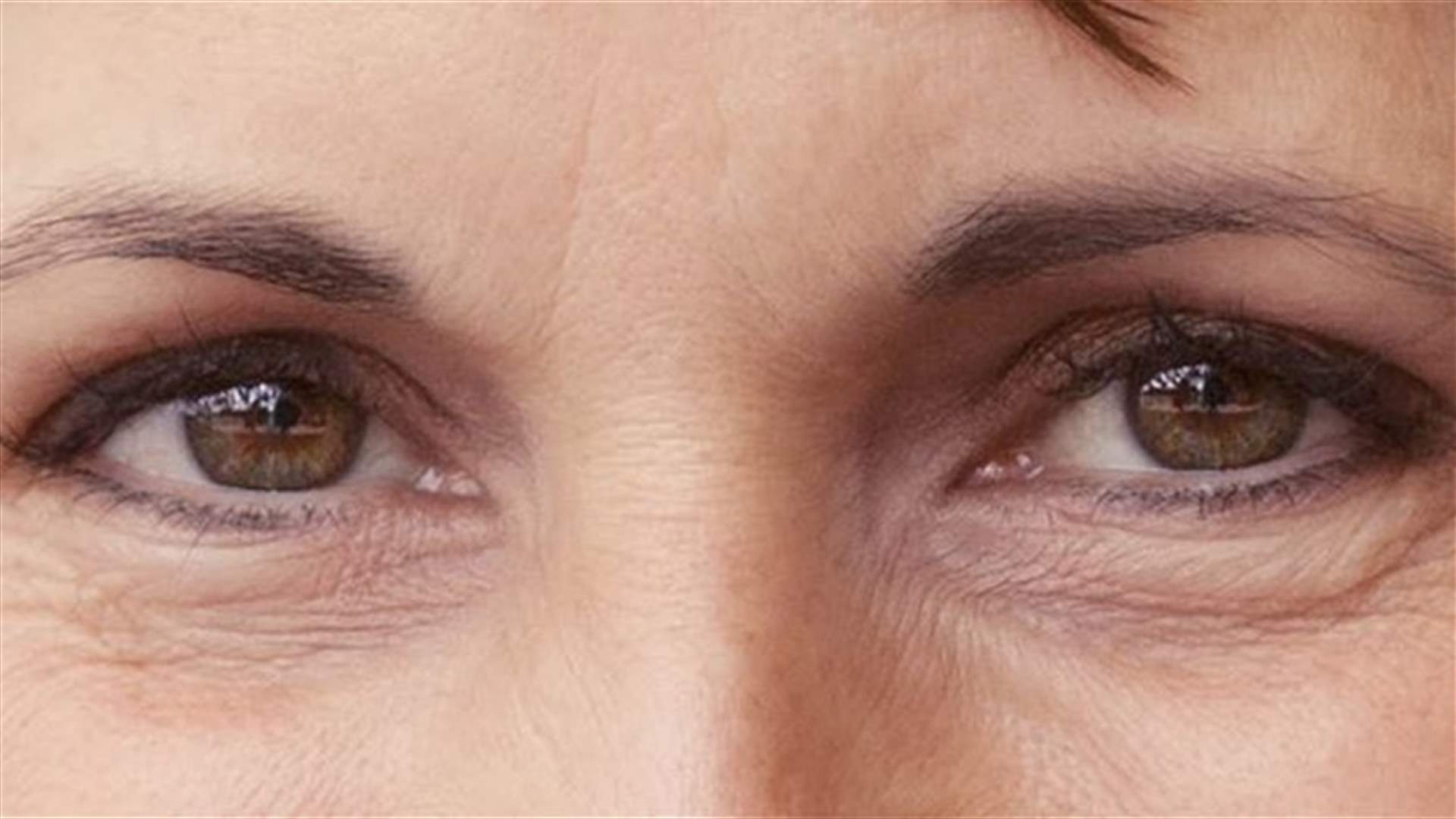 كيف تتخلصين من التجاعيد الصعبة حول العين