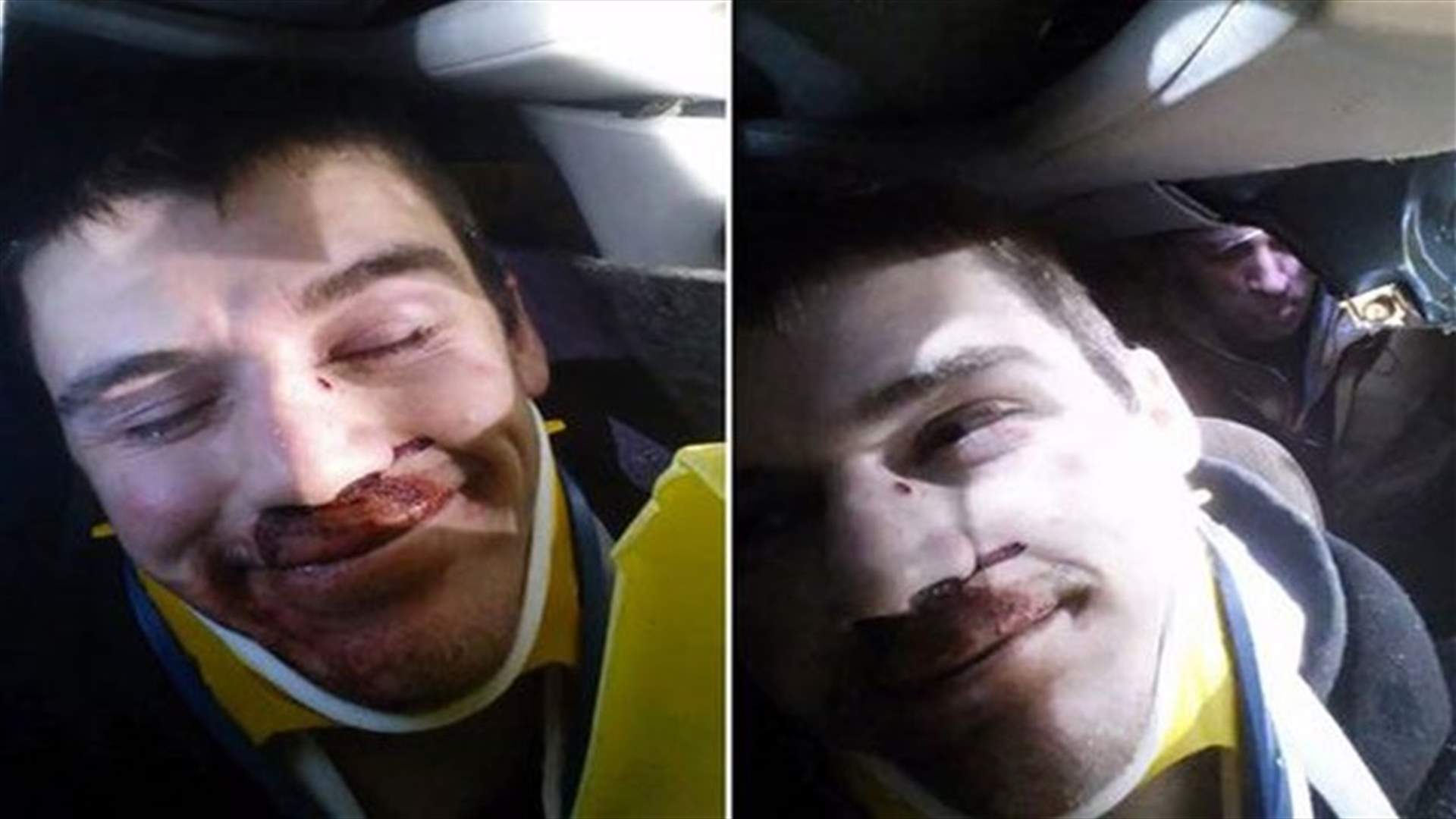 [VIDEO] Selfie Time: Man Films Himself Being Cut From Car Wreckage!