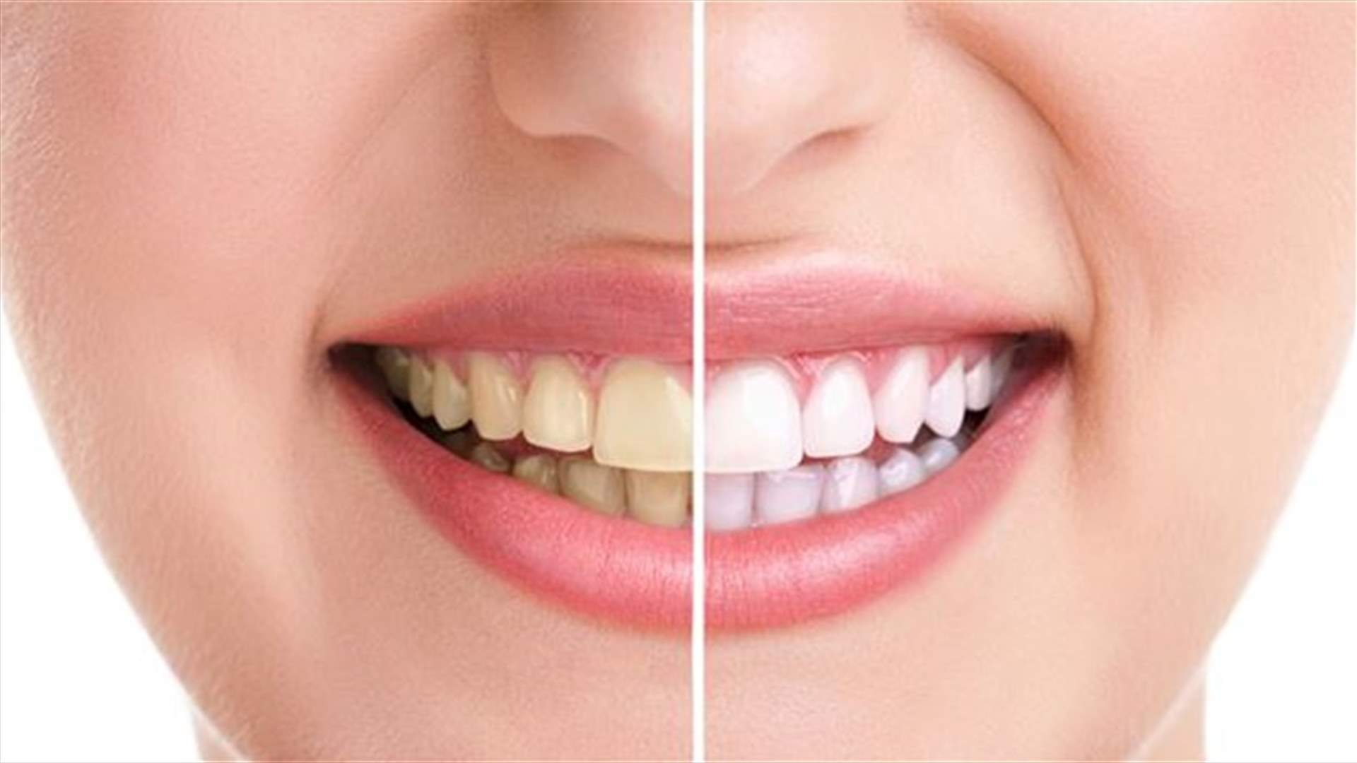 DIY Teeth Whitening Solution 