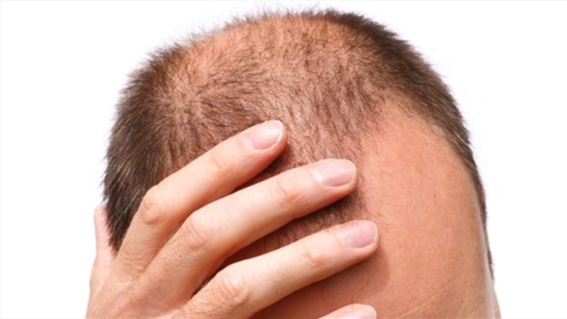 The Simplest Russian Treatment For Hair Loss