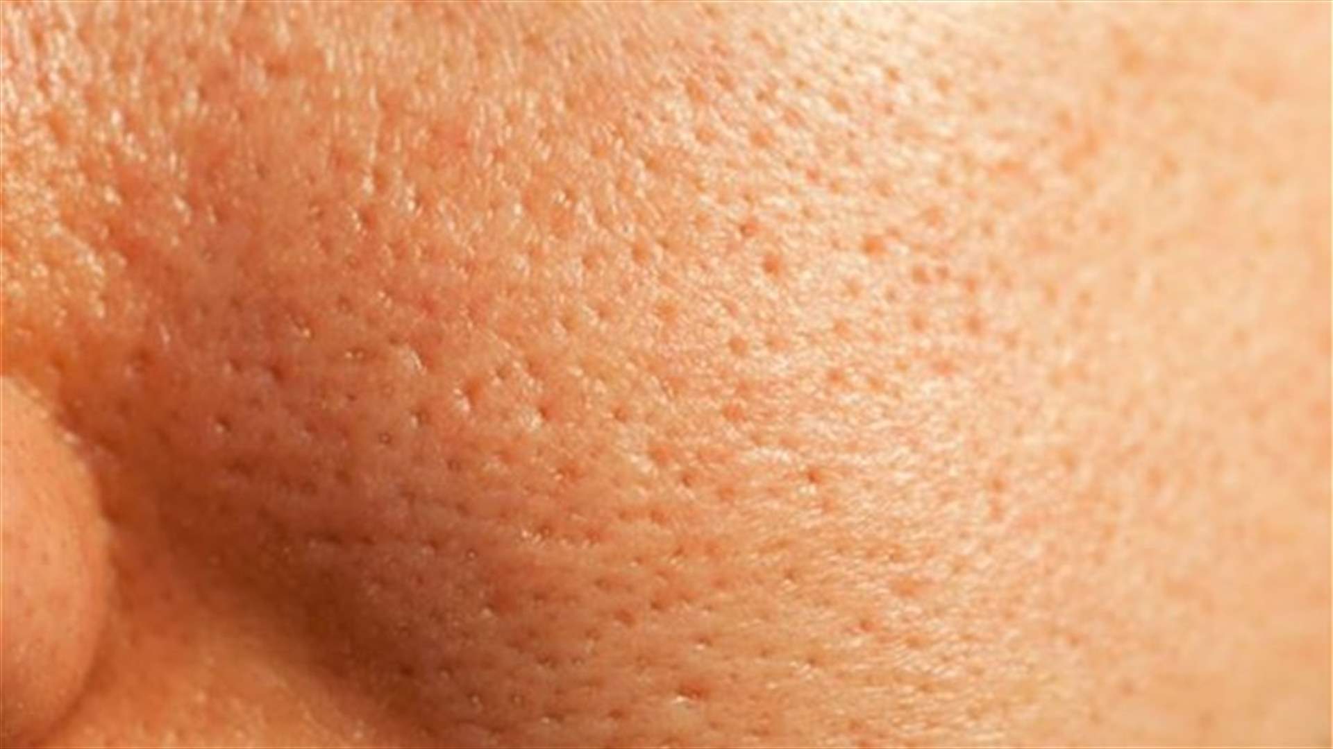 5 وصفات منزلية سهلة لمعالجة المسام الواسعة