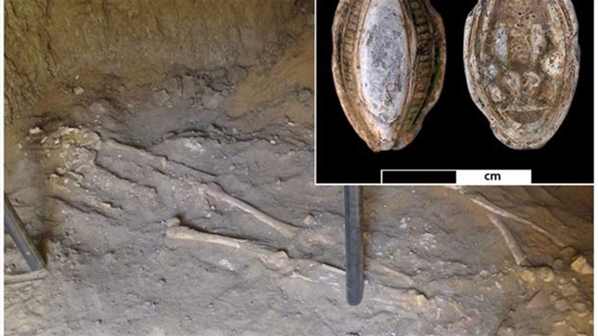 Oldest Evidence Of Breast Cancer Found In Egyptian Skeleton