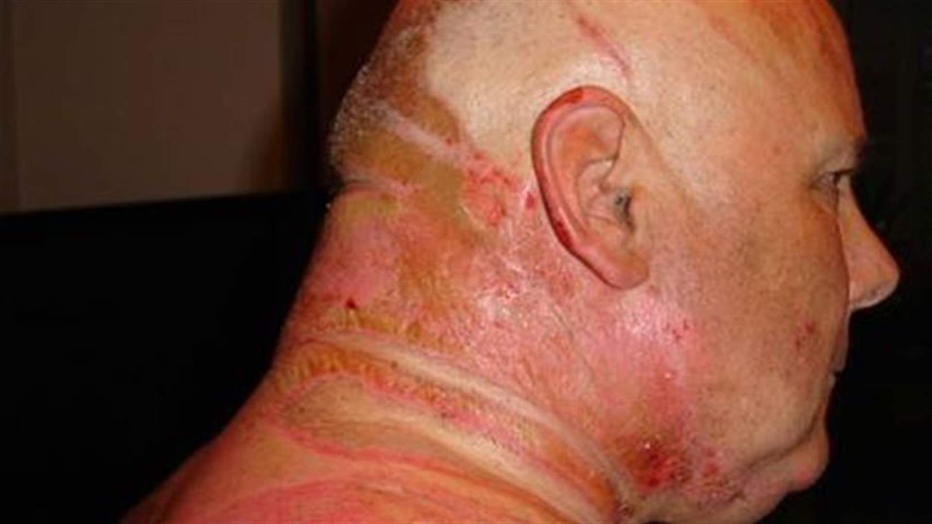 بعدما "سلقت" زوجها...حكم عليها بالسجن 4 سنوات