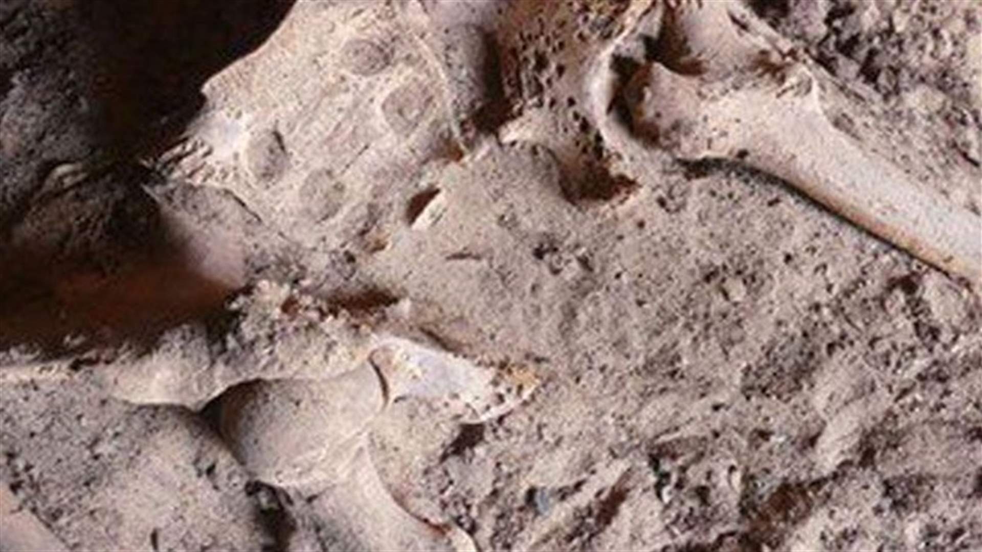 أقدم إصابة بسرطان الثدى لسيدة فرعونية