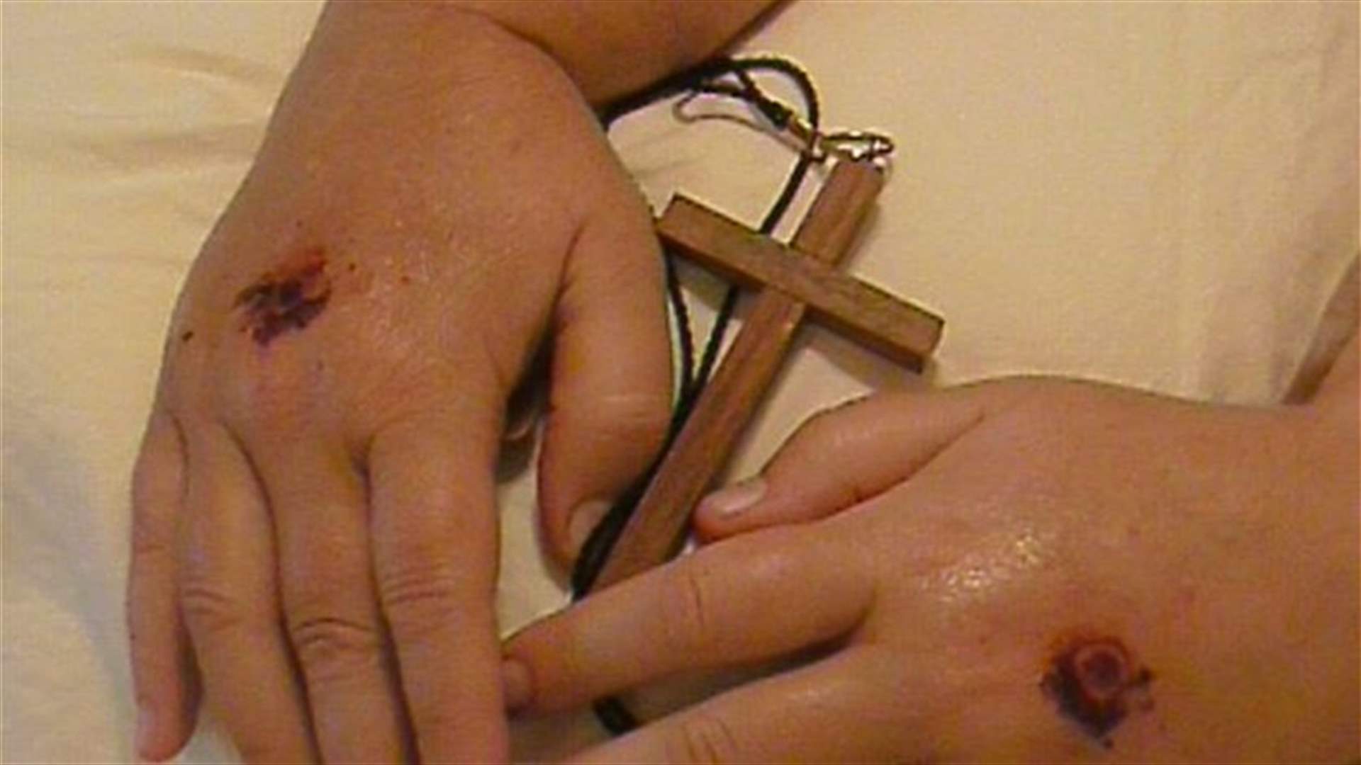 [PHOTOS] Seven People Who Bore The Wounds Of Christ