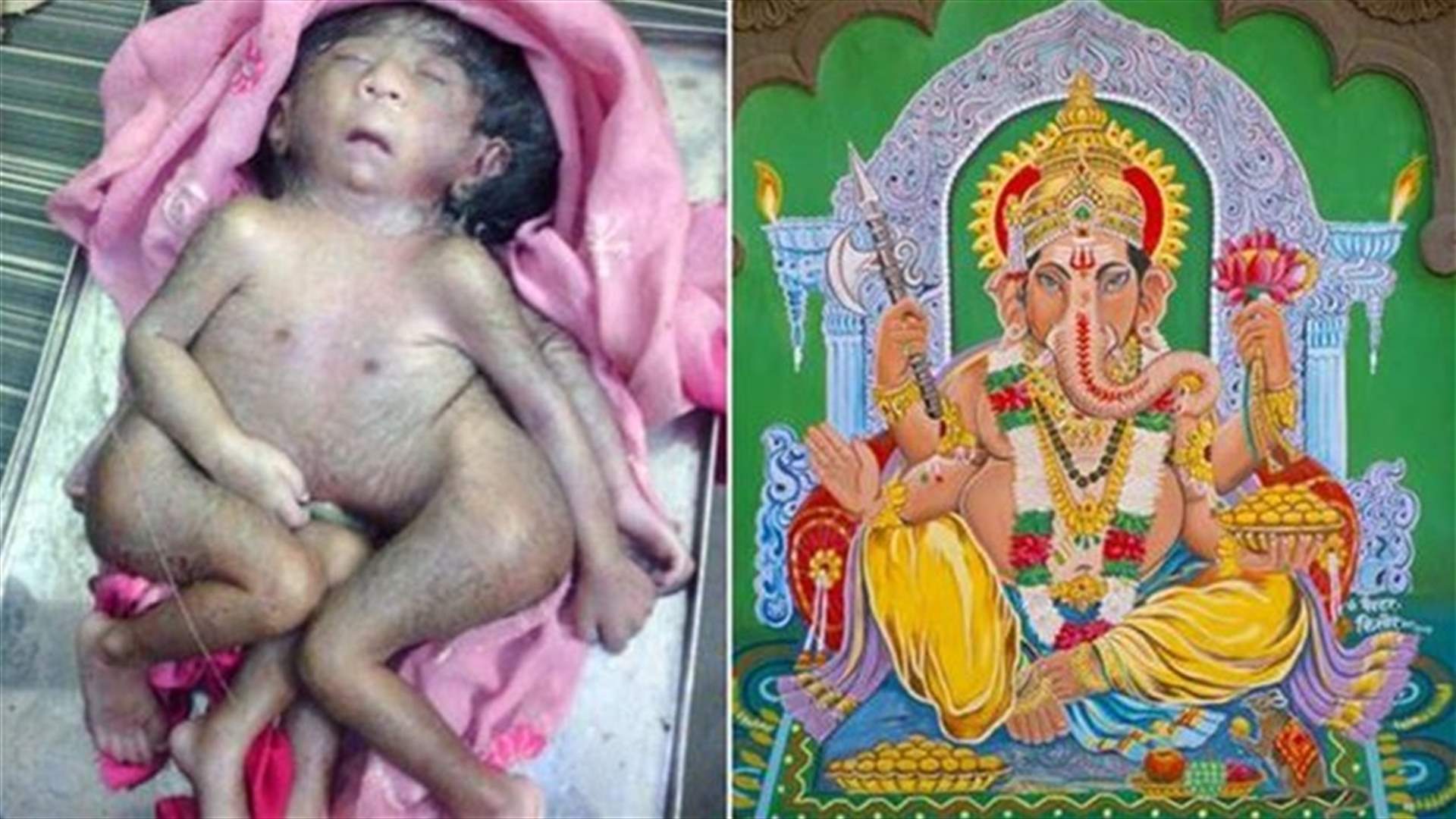 [PHOTOS] Thousands Worship Eight-Limbed Baby, Say He Is A Reincarnation Of Hindu God