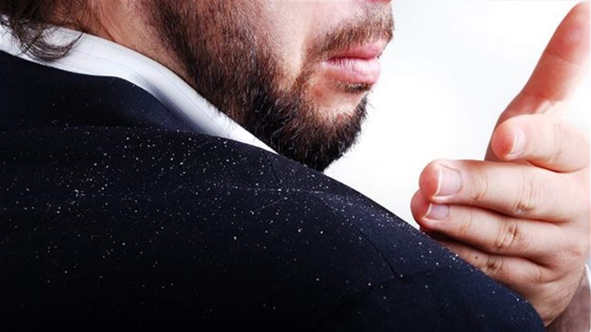 ‏5 طرق طبيعيّة للتخلّص من قشرة الرأس