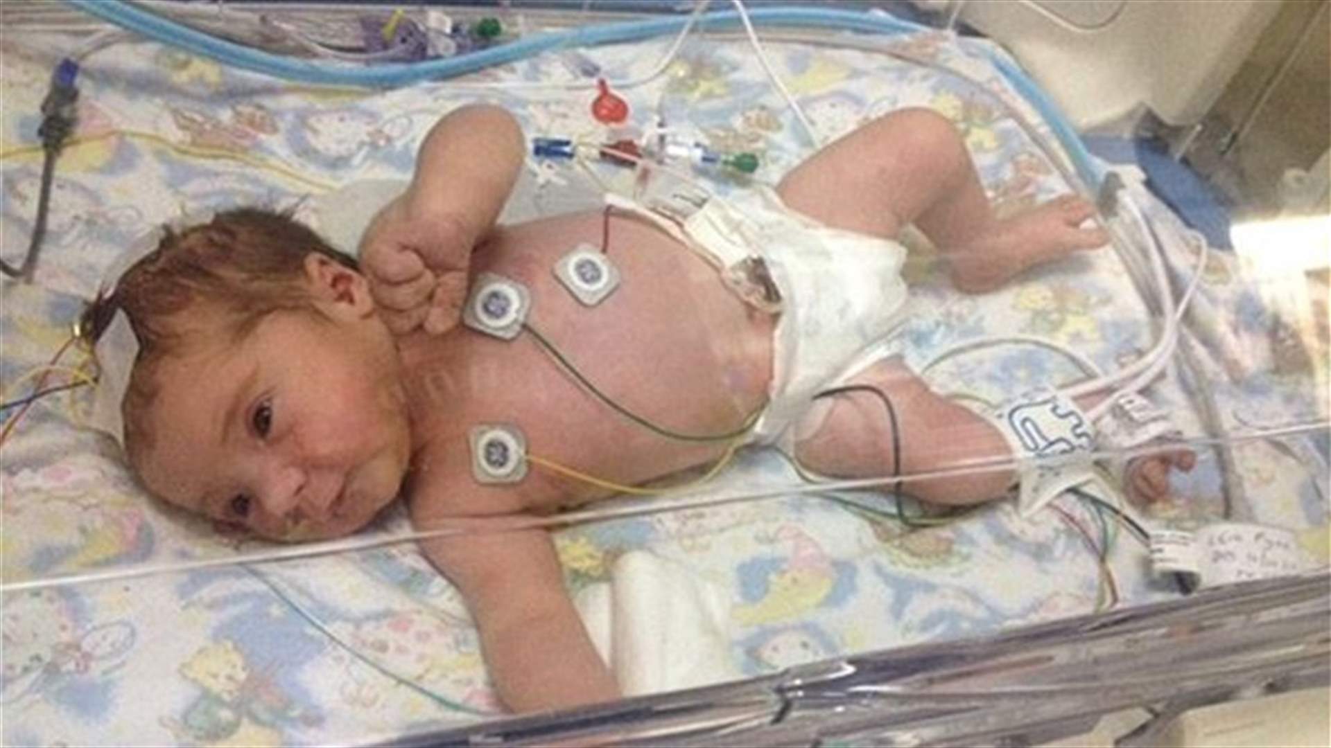 بالصّور: لحظة عودة رضيعة من الموت!