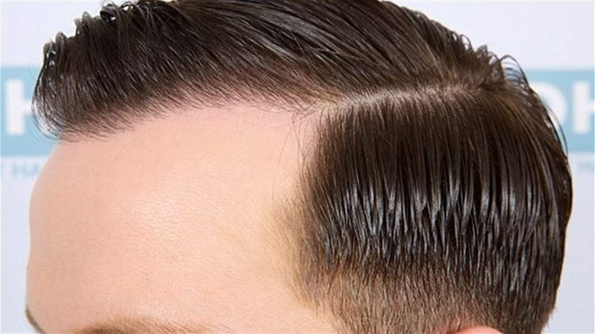 التقنية الاكثر دقة لاستعادة الشعر الطبيعي خلال بضع ساعات
