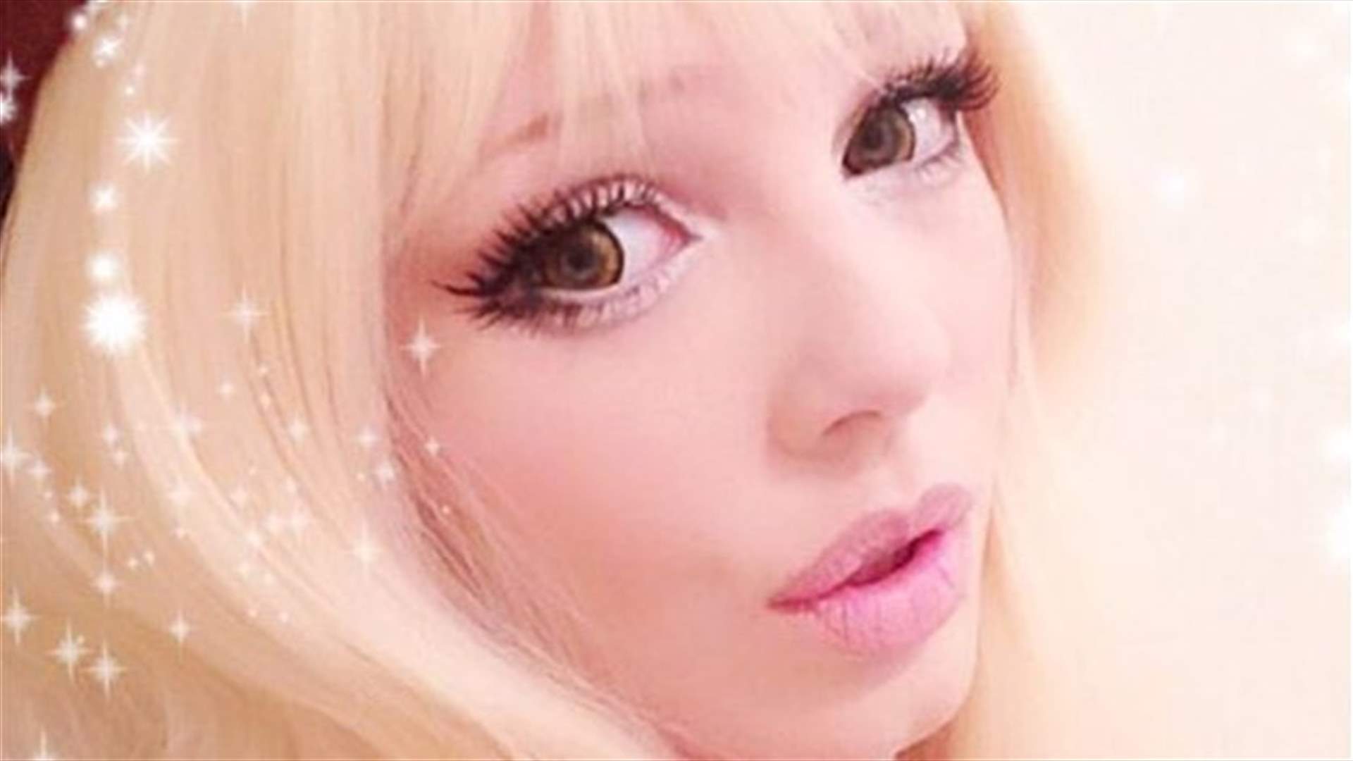 بالصّور: مرضها حوّلها الى لعبة باربي حقيقيّة