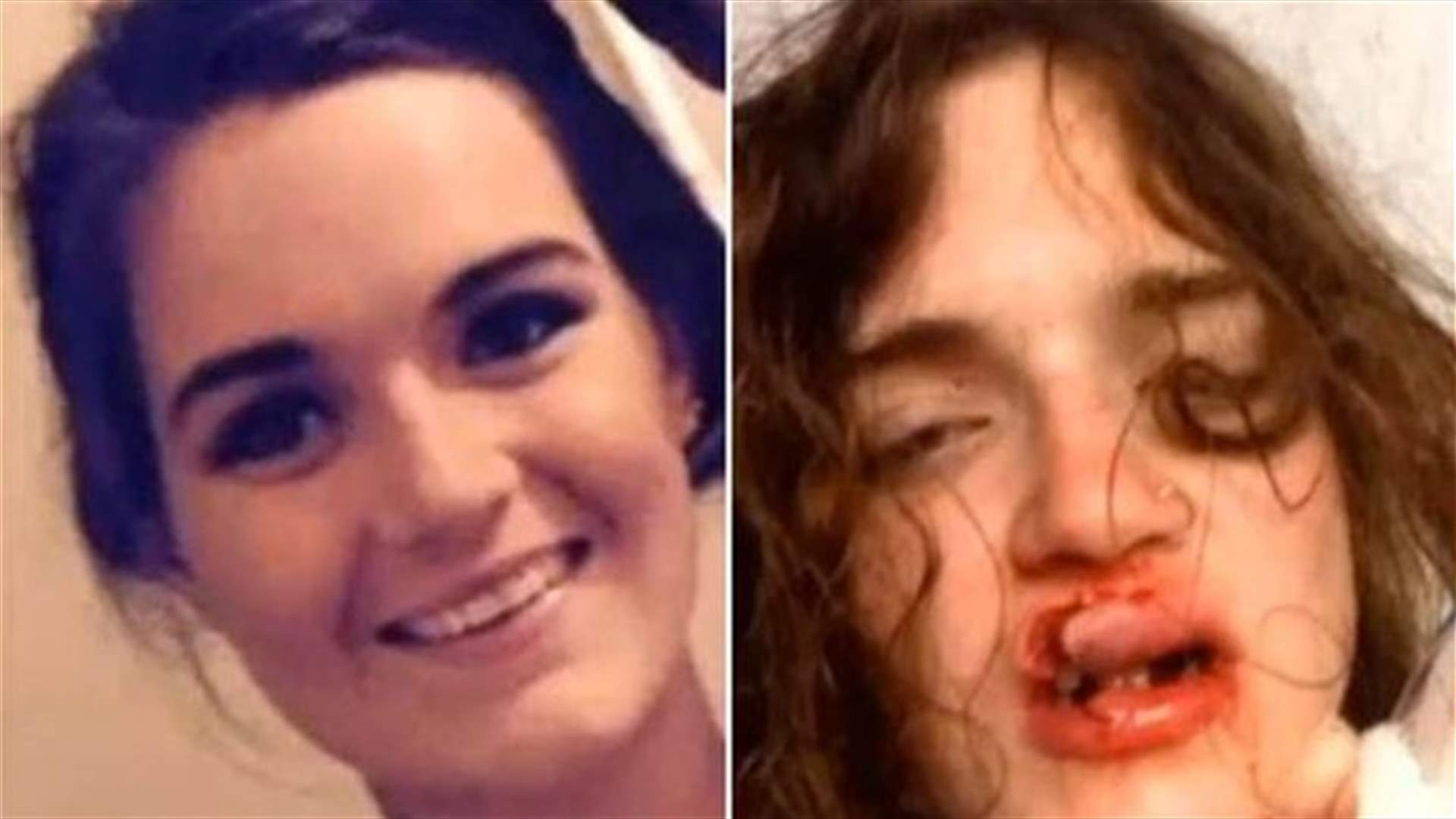 اعتدوا عليها بسبب البيكيني