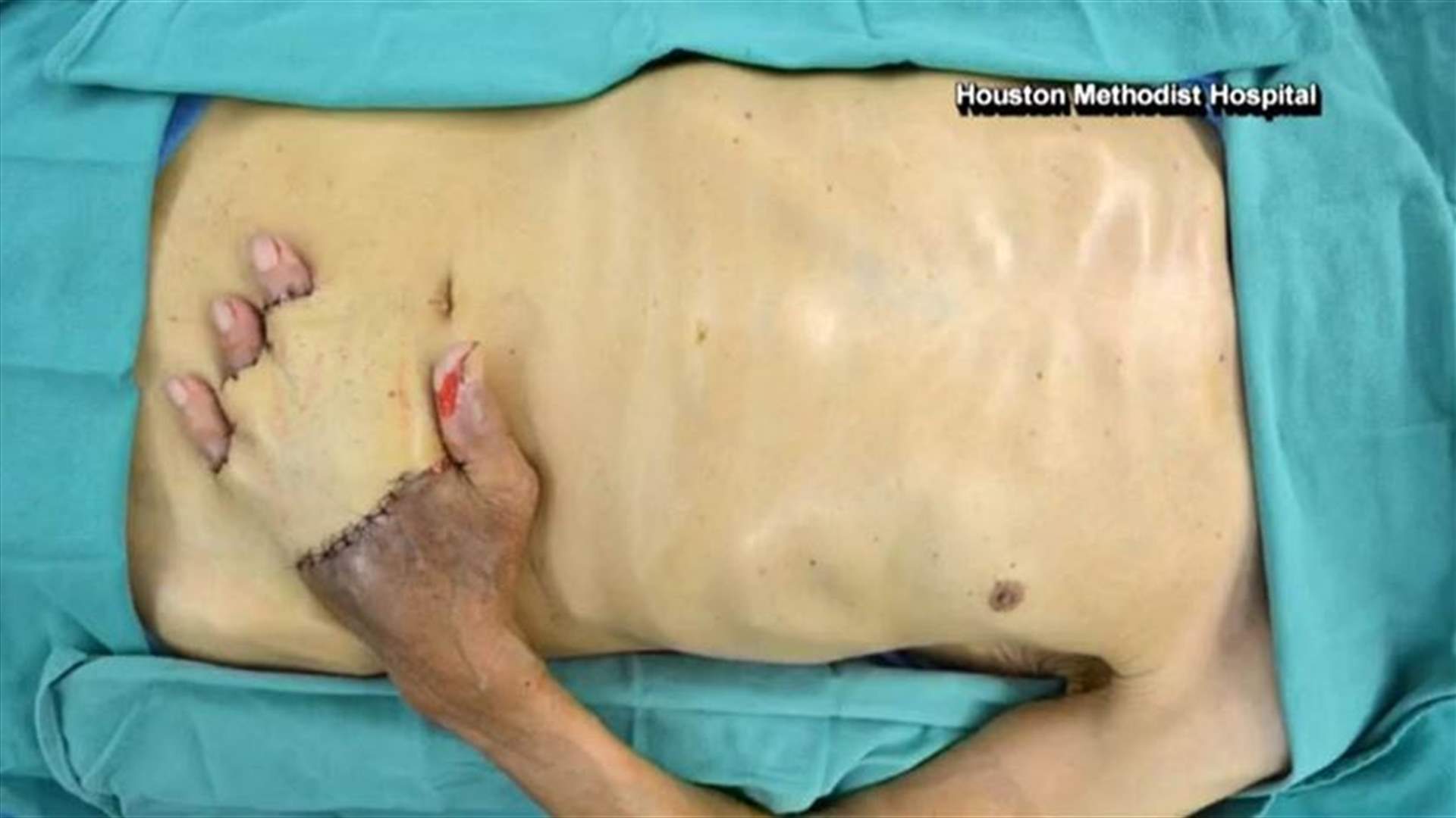 بالفيديو: لماذا زرعوا يده داخل بطنه؟
