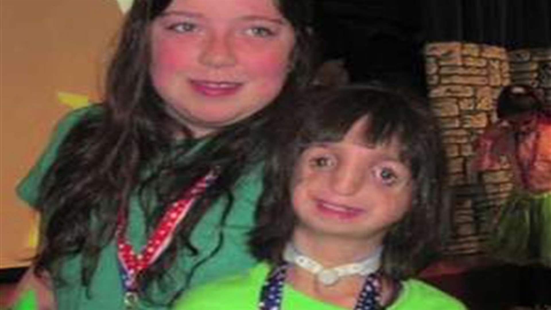 Girl with deformed face learns to navigate world