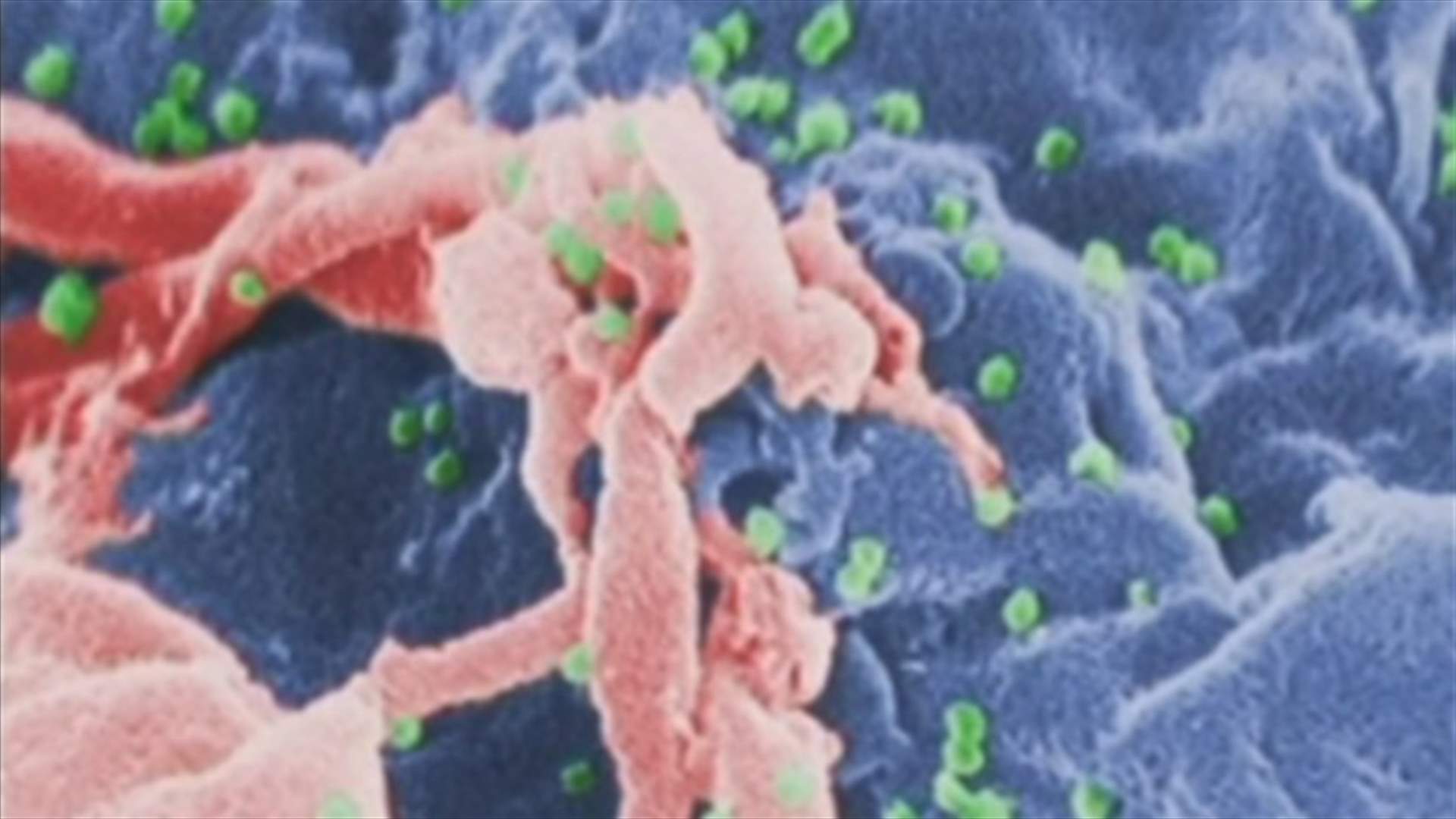 The “Berlin patient”: first person to be cured of AIDS  