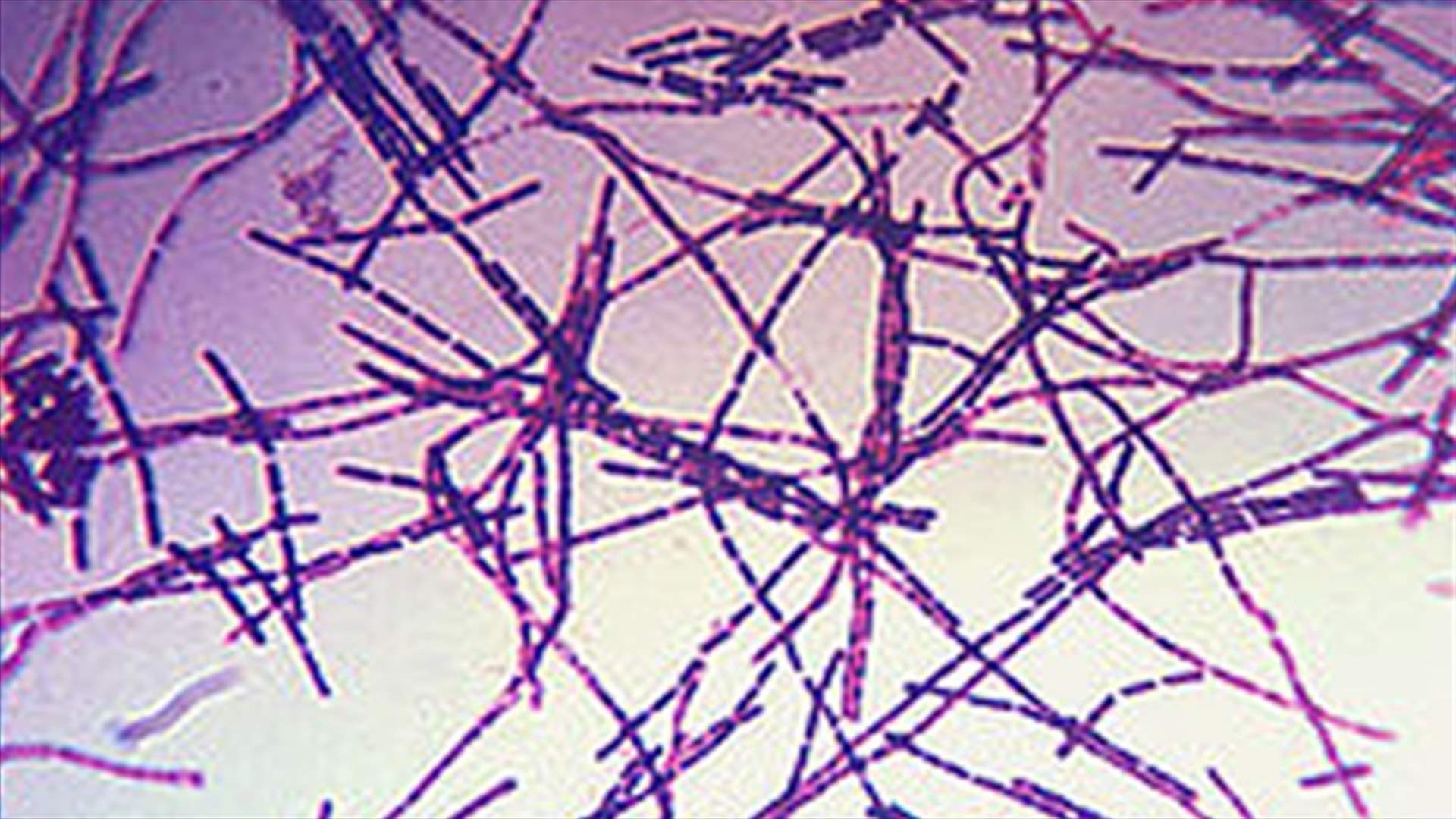 British anthrax death sparks outbreak concern
