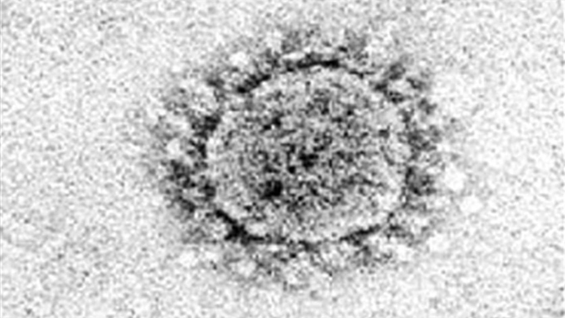 New SARS-like virus detected in Middle East