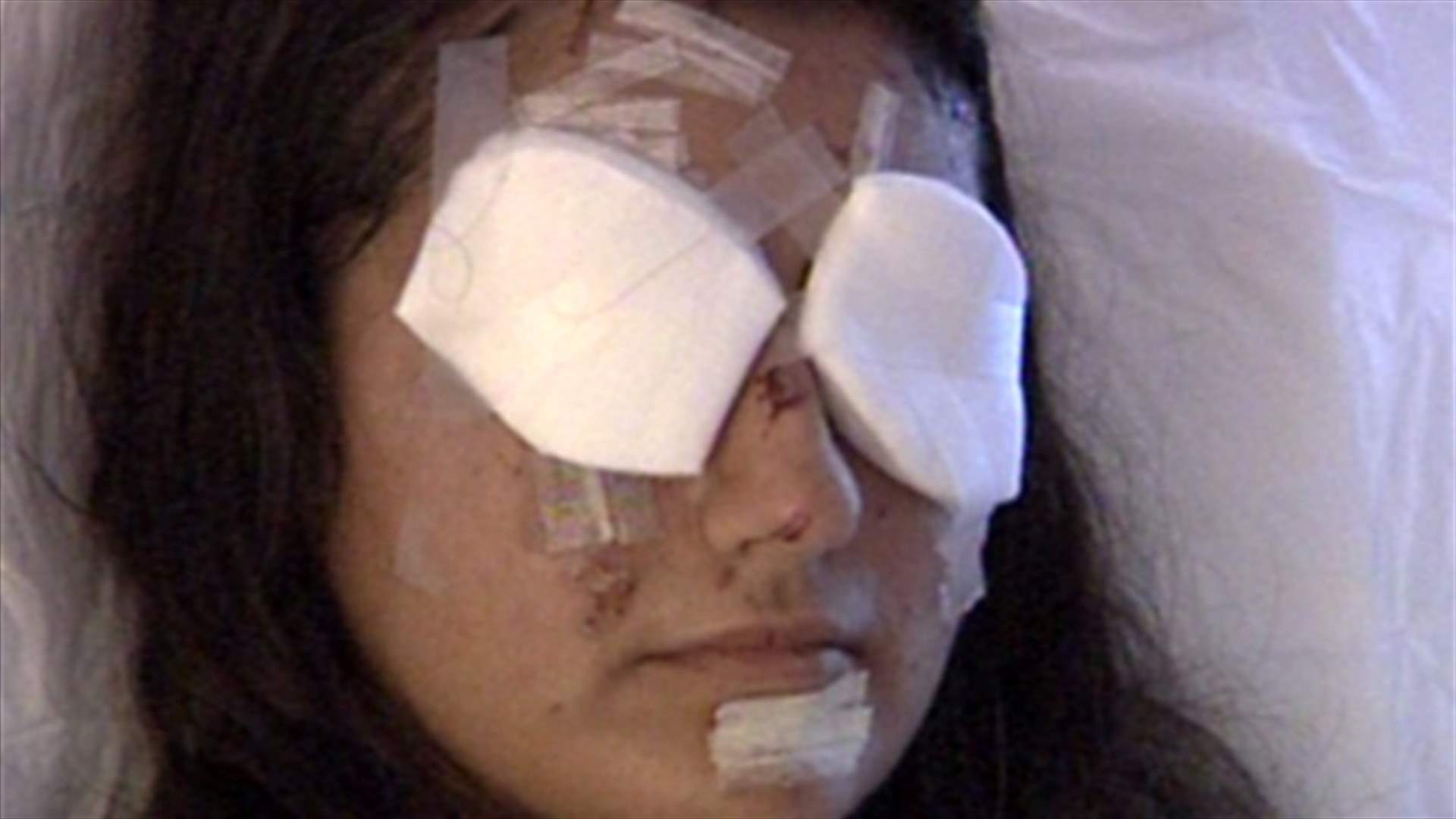 REPORT: Ashrafieh victims: subjects of blatant disregard 