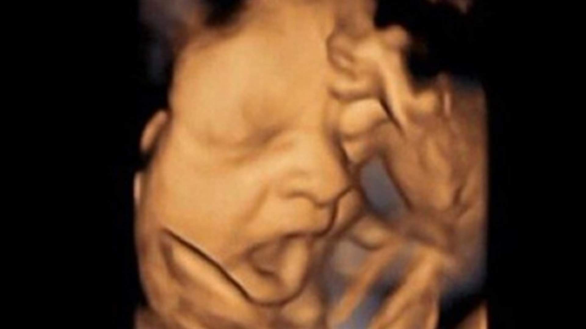 4D scans show fetuses yawn in the womb