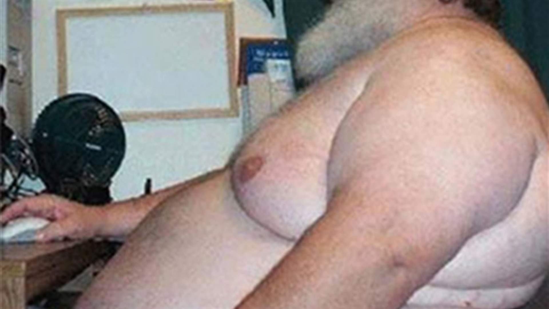 Obese man dies for not fitting into the CT scan machines