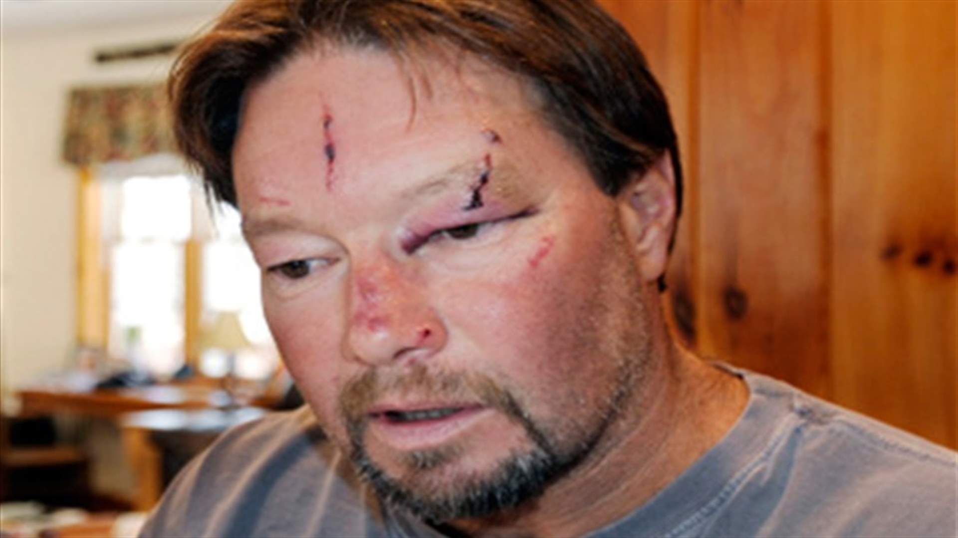 Bobcat attacks man in garage