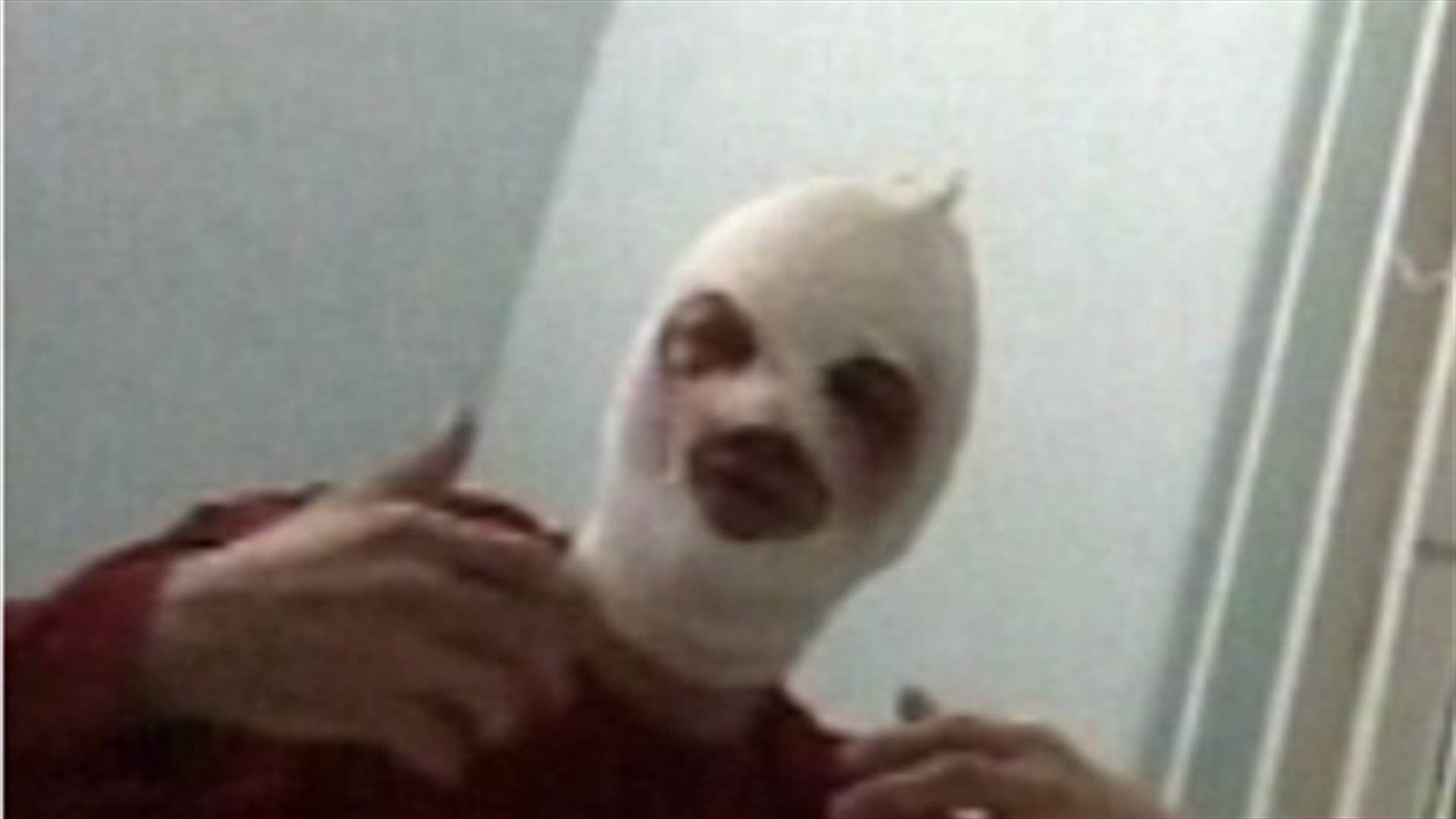 REPORT: Bolshoi ballet chief has surgery after acid attack