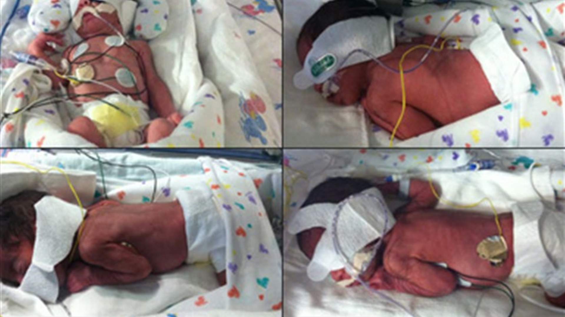 Texas woman has two sets of identical twins in one day