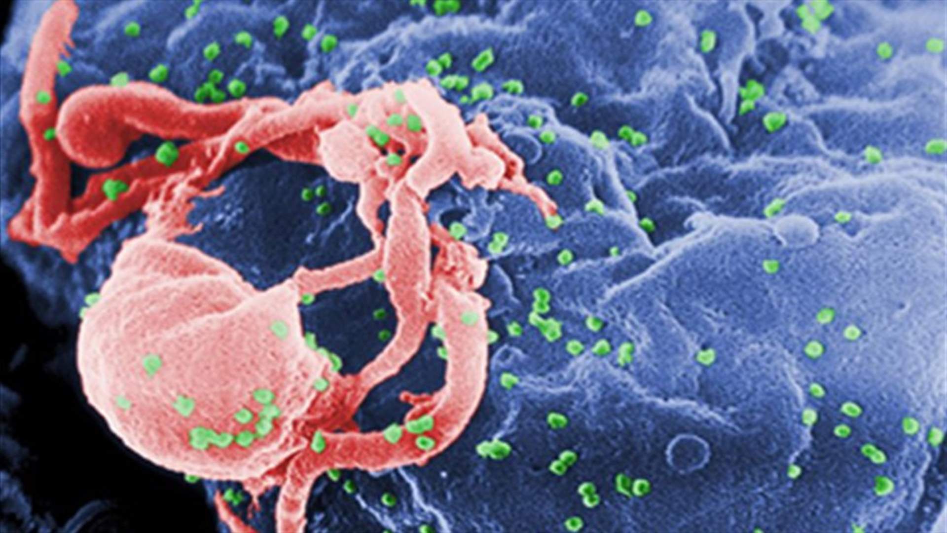 Scientists: Baby born with HIV apparently cured