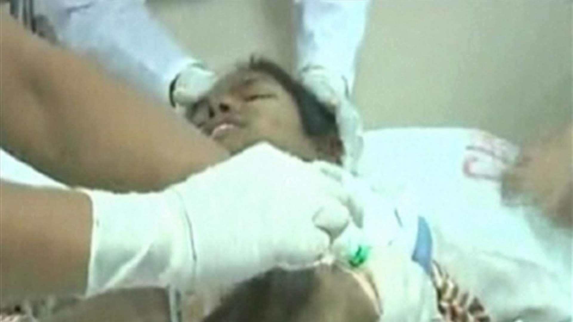"رشمي" قاومت الموت سبعة عشر يوماً
