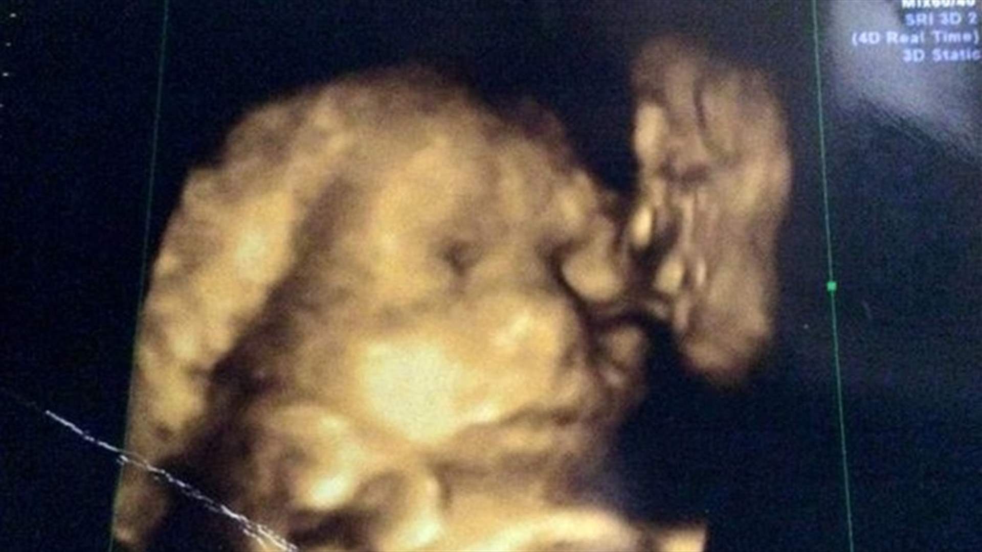 بالصور: رأت جدّها المتوفي في صورة جنينها