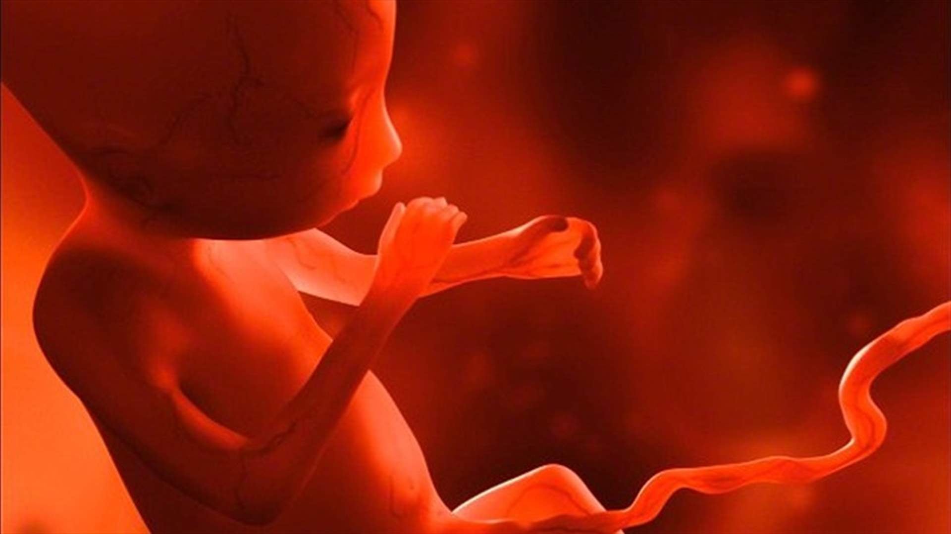 طفل في الرابعة من عمره حامل بتوأمه!