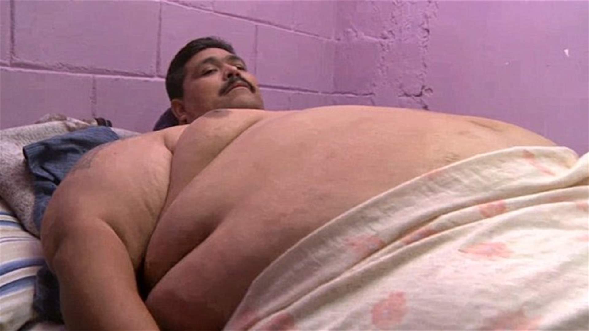 أضخم رجل في العالم يخضع لجراحة تصغير معدة 