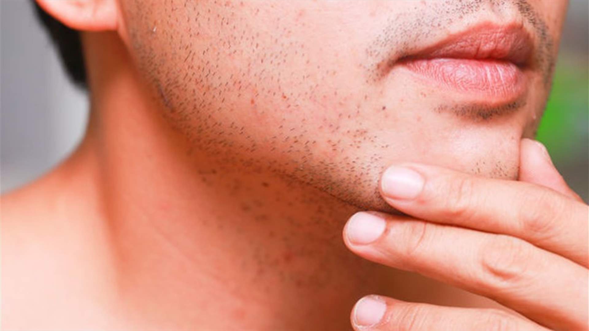 كيف تتخلّص من حساسيّة البشرة بعد الحلاقة؟