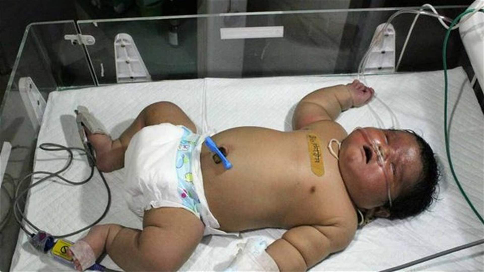 بالصورة: أكبر مولود في العالم يزن 7 كيلوغرامات