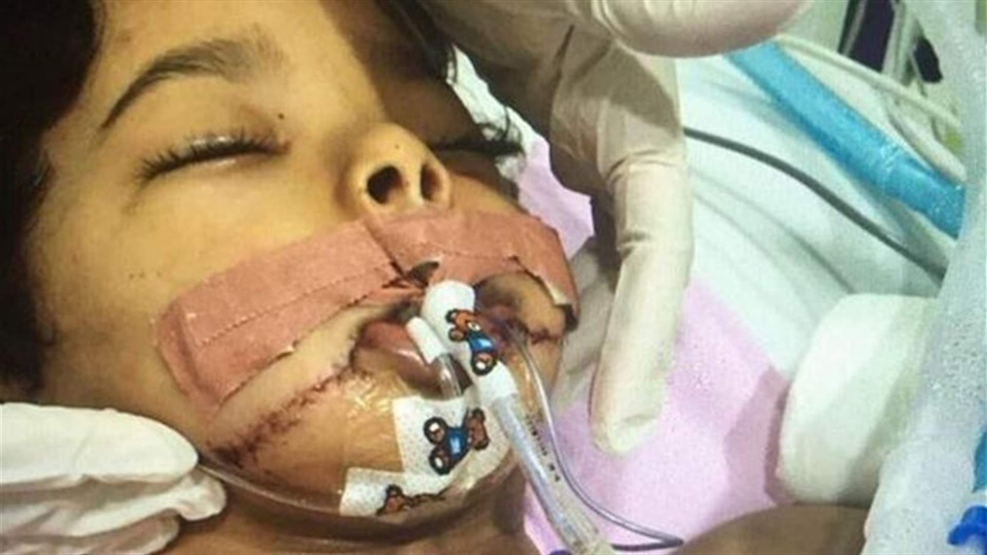 خادمة أثيوبية حاولت فصل رأس طفل سعودي عن جسده