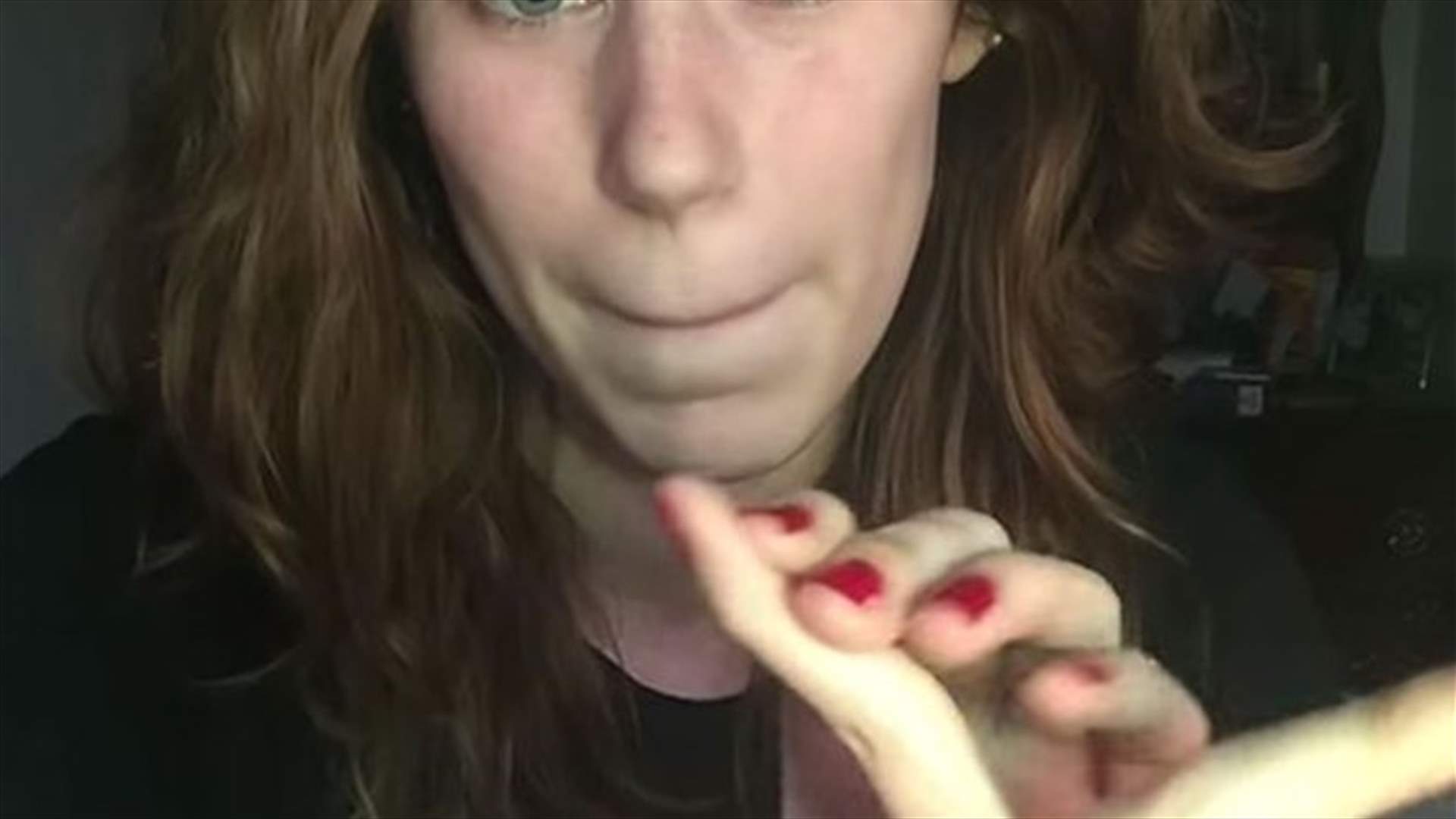 [PHOTOS & VIDEO] Woman Bends Her Fingers Right Back Over Her Knuckles 