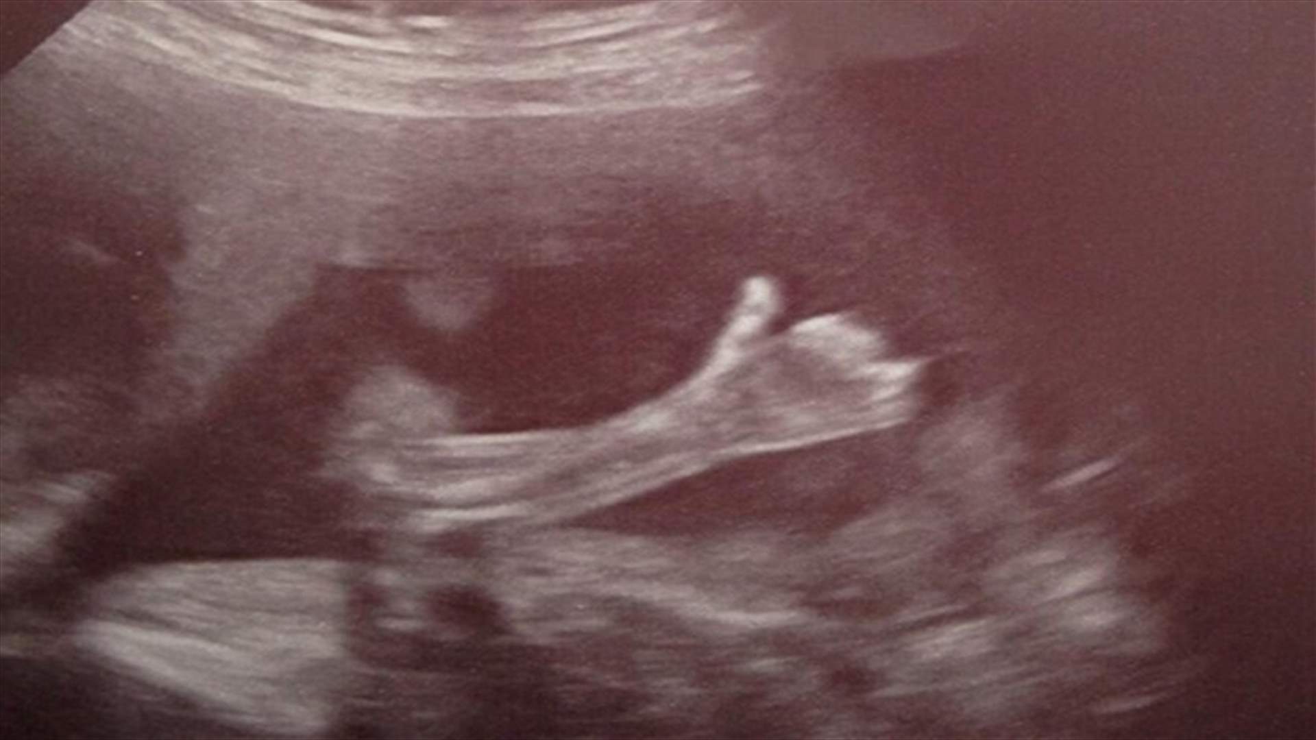 بالصور: جنين يرفع ابهامه ليطمئن والديه أنه بخير 