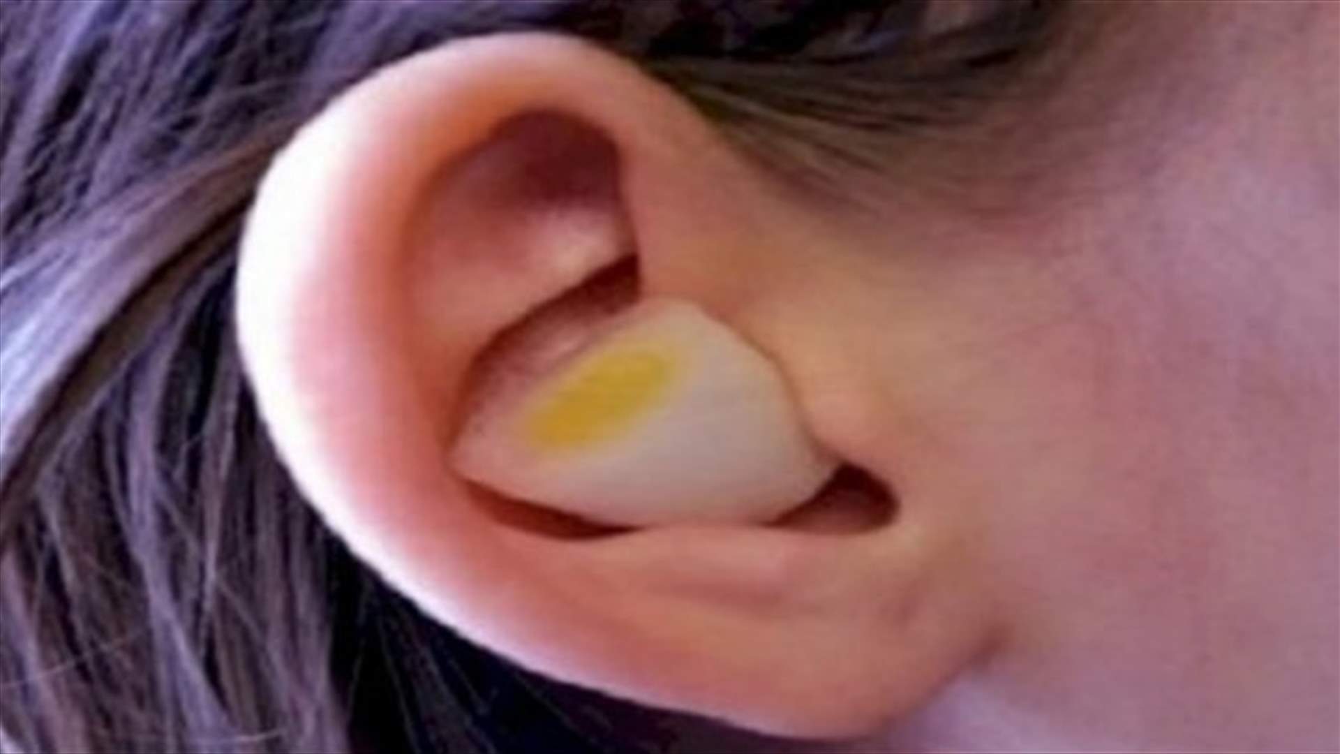 هذا ما يحصل عند وضع البصل في الأذن طوال الليل