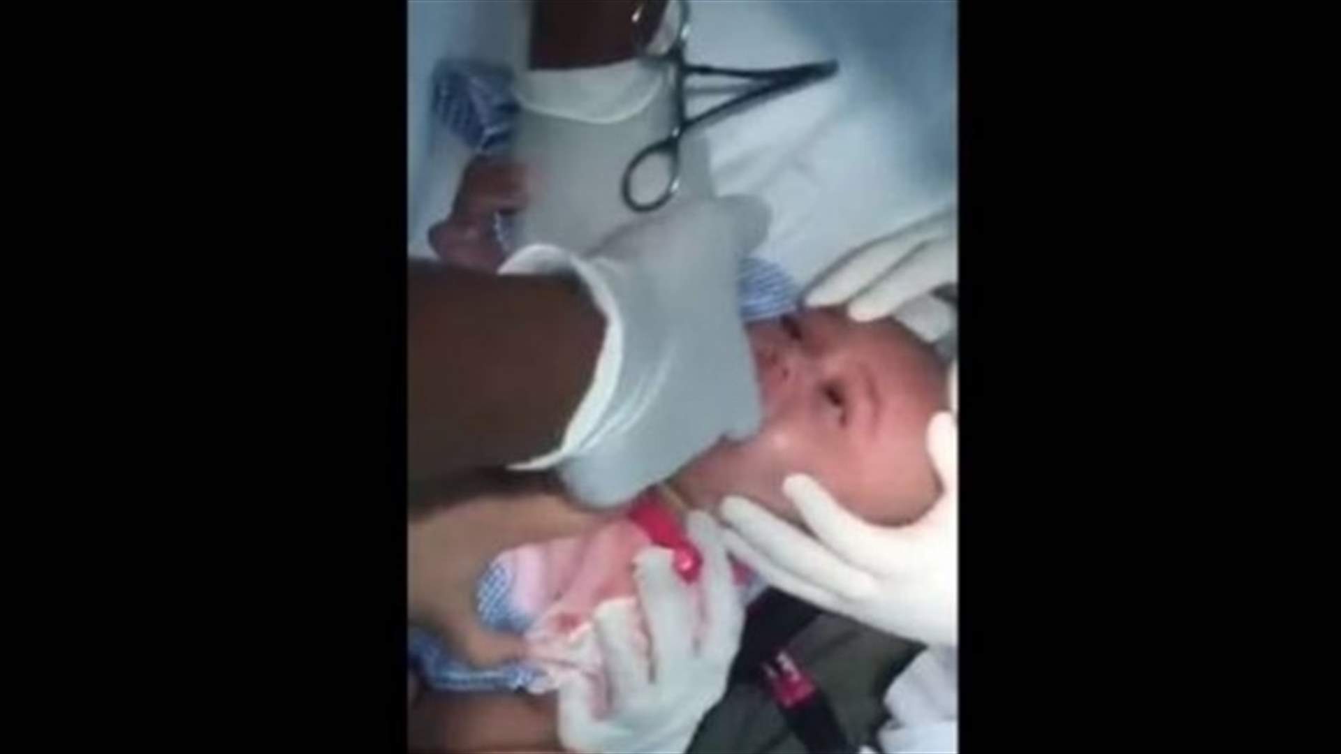 بالفيديو: استخراج ساعة من حلق رضيع في السعوديّة