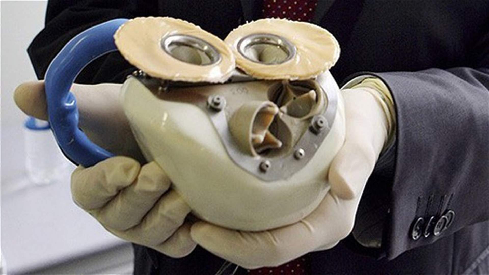 في فرنسا: وفاة ثالث شخص بقلب إصطناعيّ