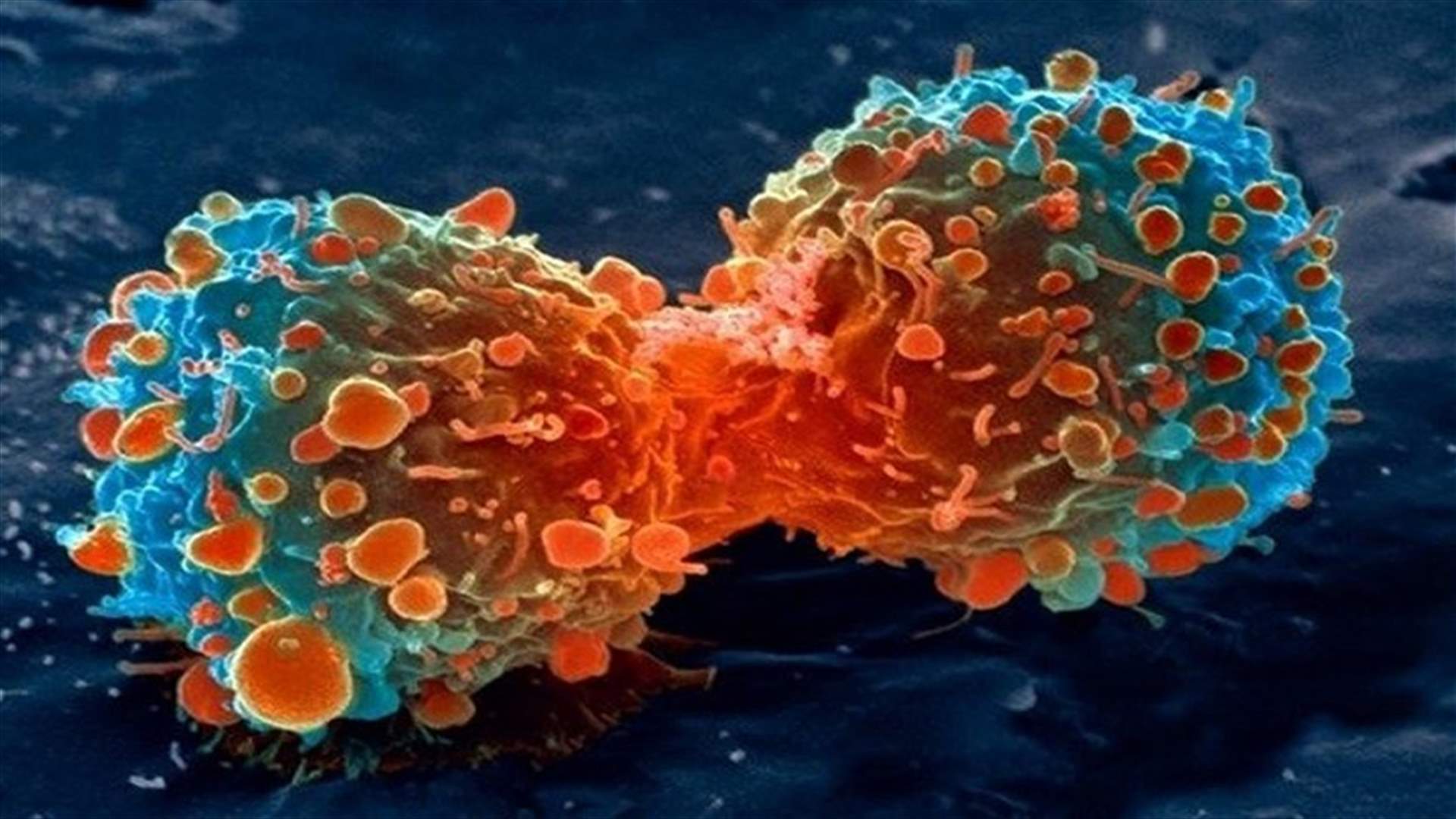في الصين: أوّل جهاز لتدمير الخلايا السرطانيّة