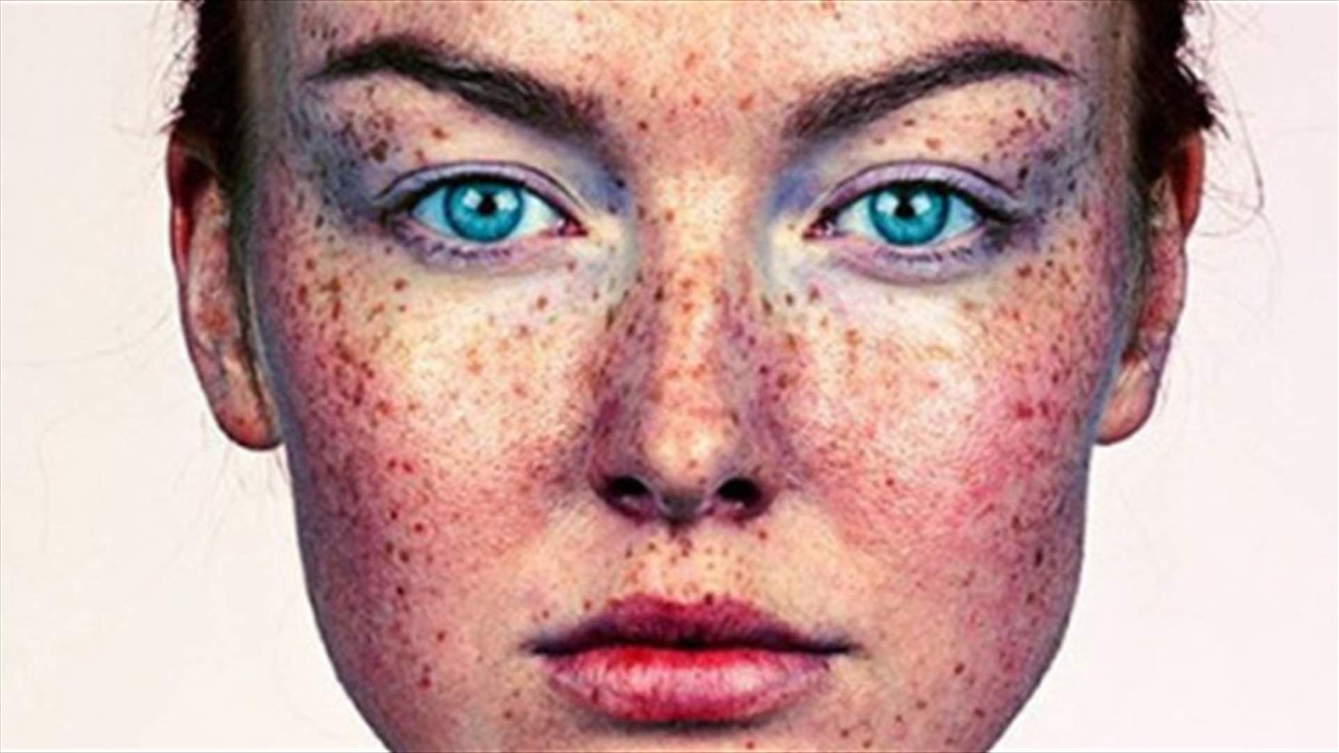 كيف تتخلصين من النمش بطرق طبيعية؟