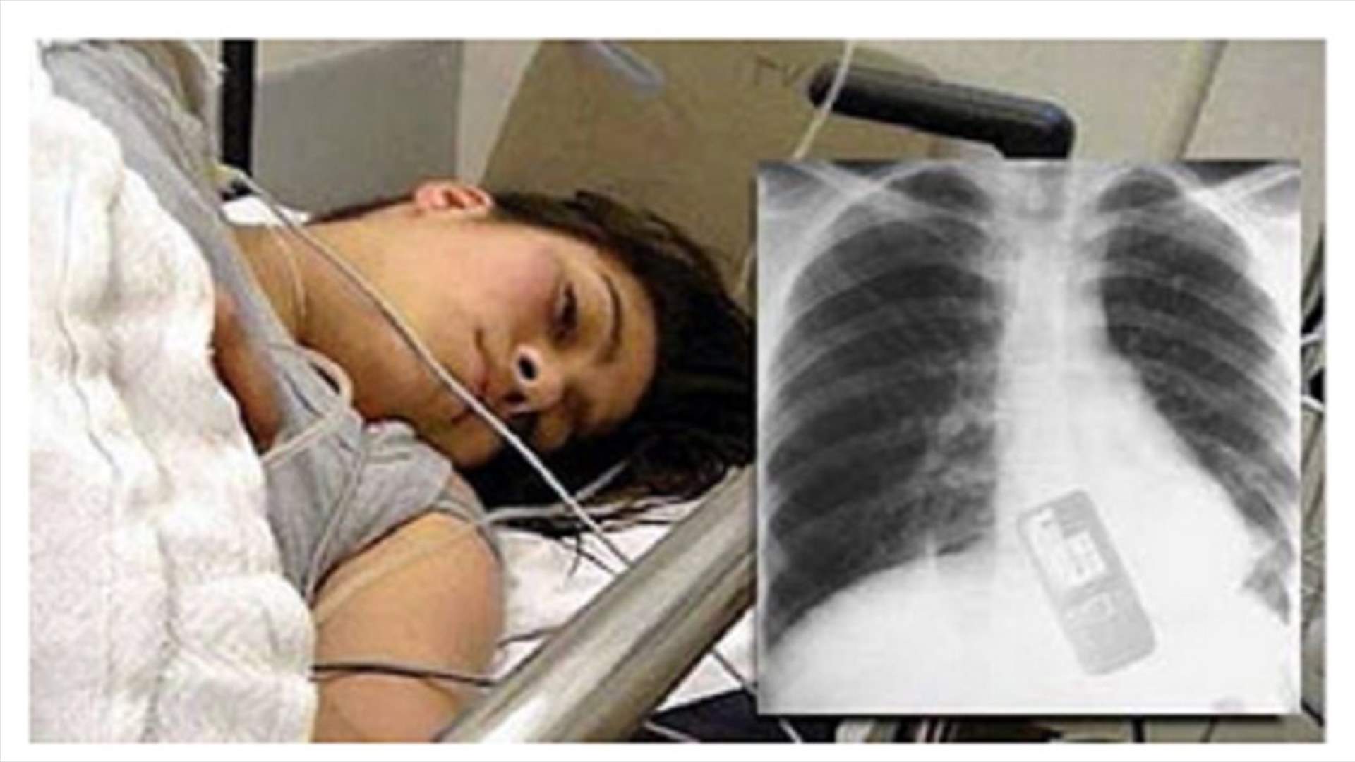 مراهقة تبتلع هاتفاً... والسبب؟