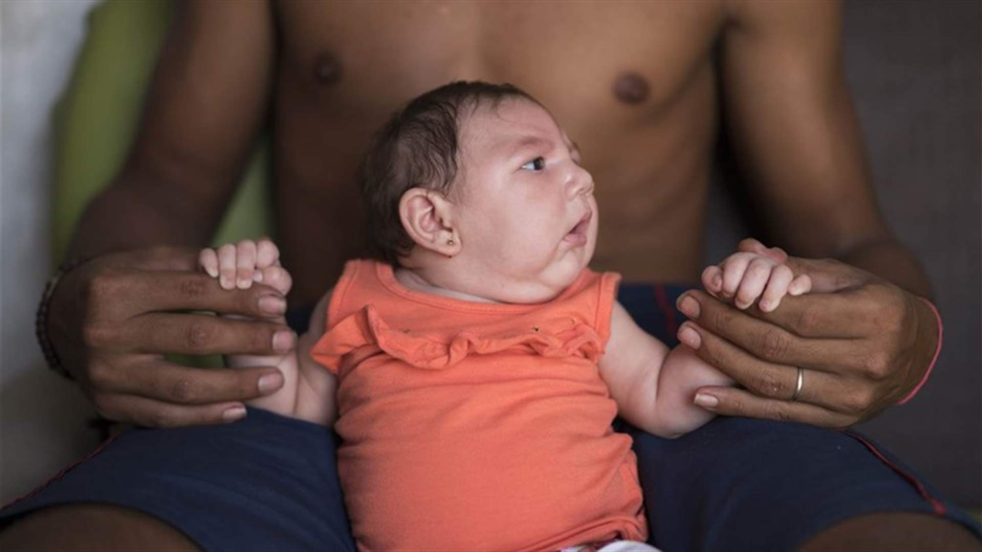 ثلاث وفيات اثر مضاعفات سببها فيروس زيكا في فنزويلا